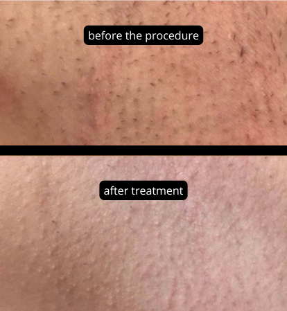 DL 6000 Pro 4. Bohman Beauty System. Your key to salon growth and profit.